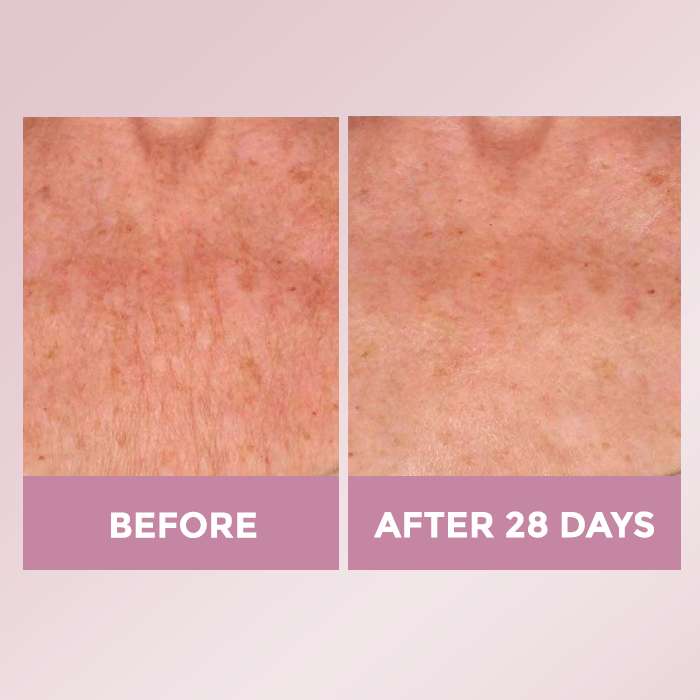 Luxe Skin Lift Cream