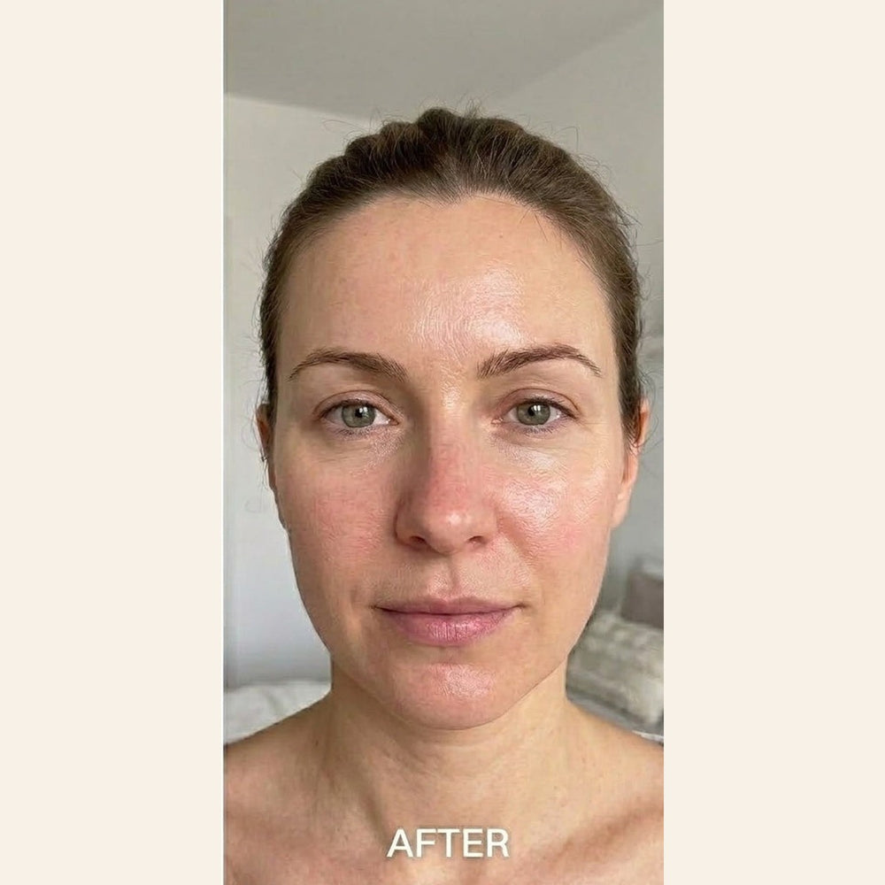 toner-ba-sq-after.jpg