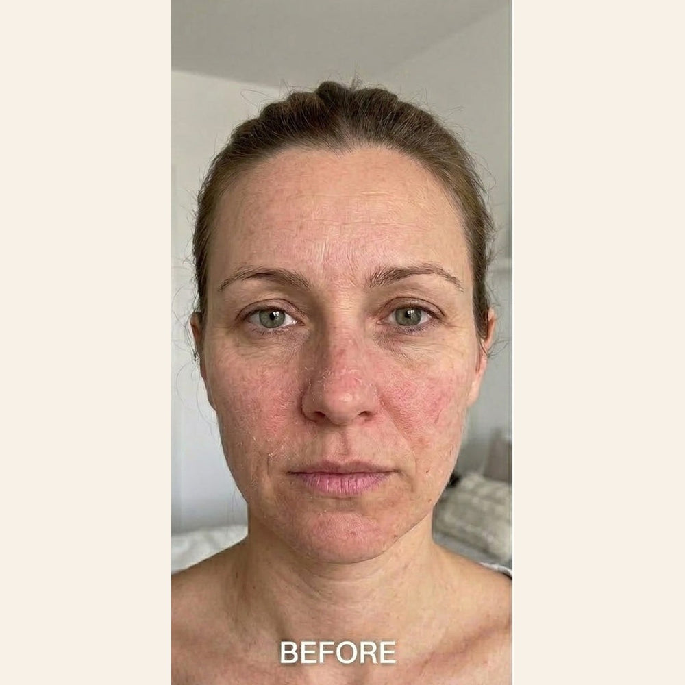 toner-ba-sq-before.jpg