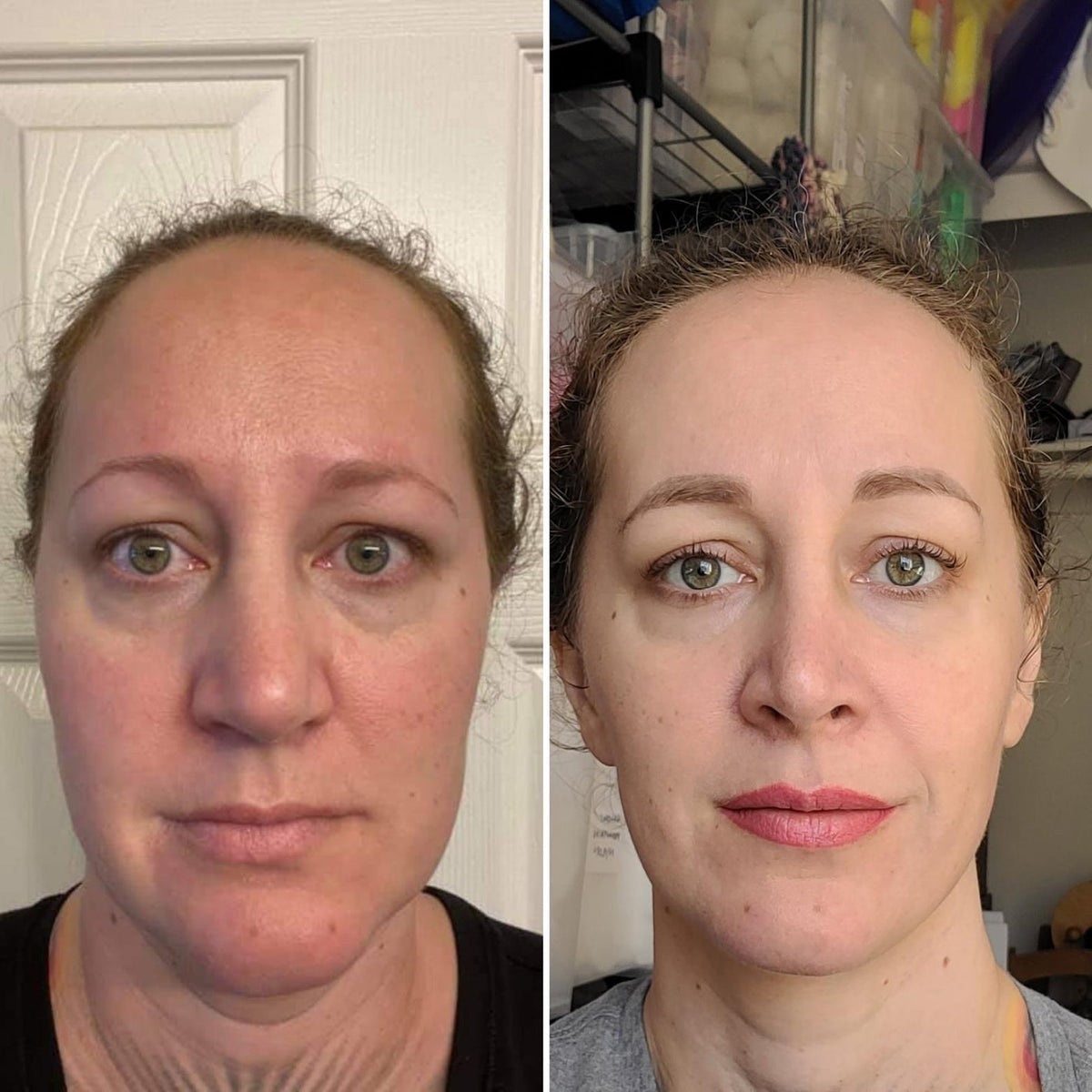 Customer result photo one