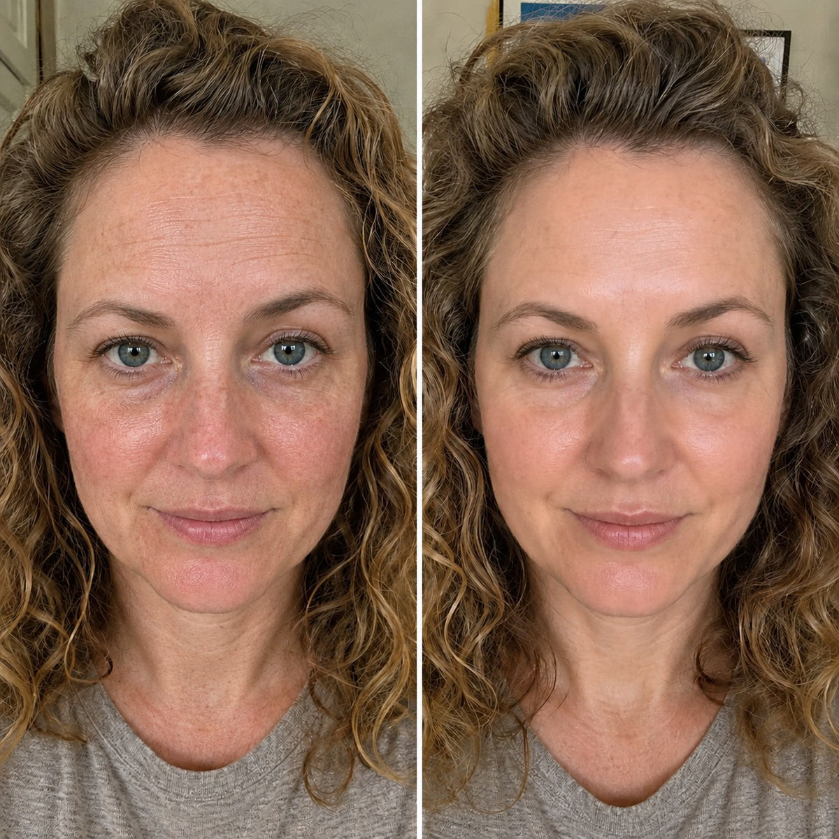 Customer result photo three