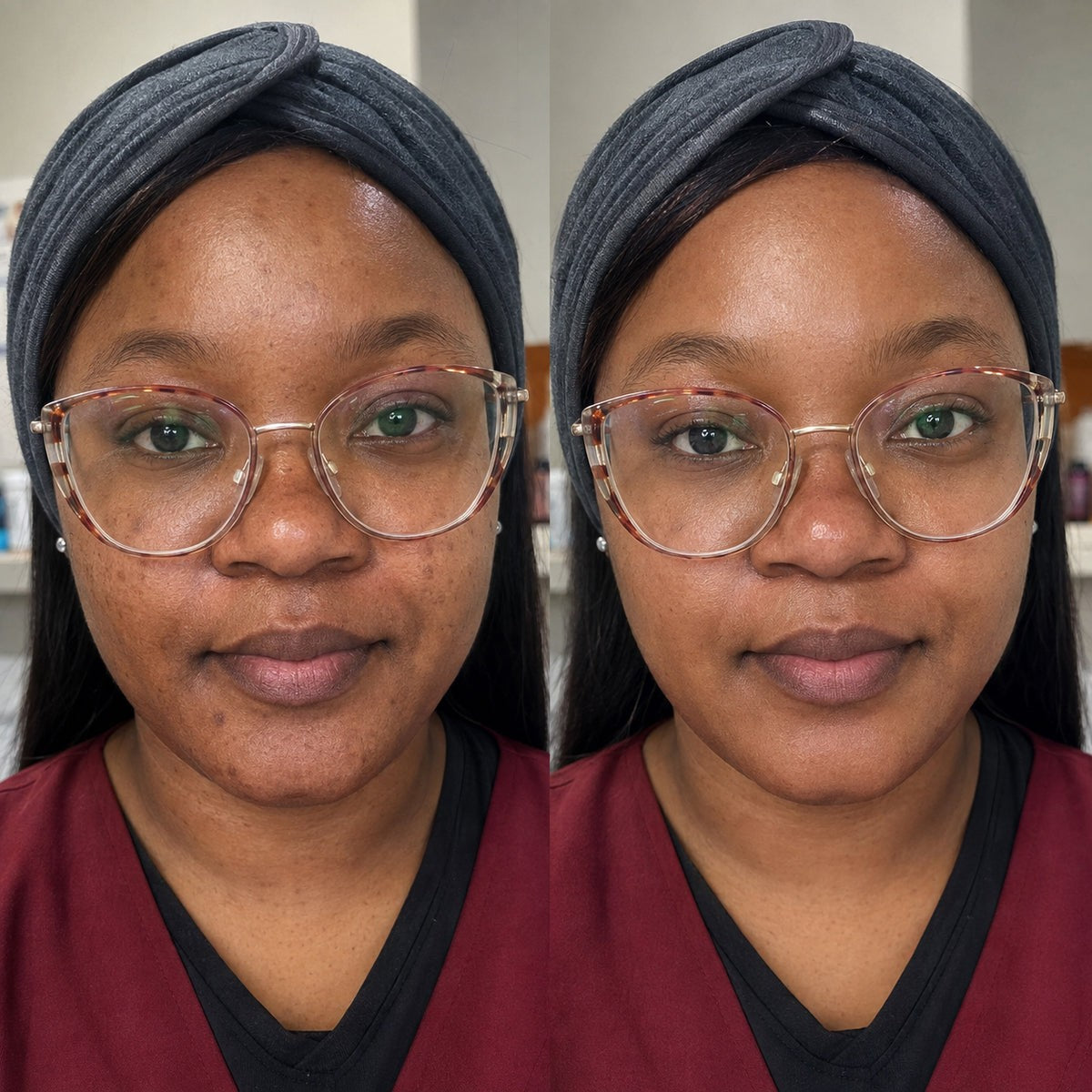 Customer result photo four
