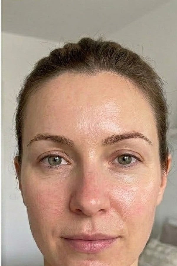 Customer after consistent daily use of EGF Peptide Firming Toner
